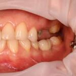 Improving Your Life Quality with Danties Protezas